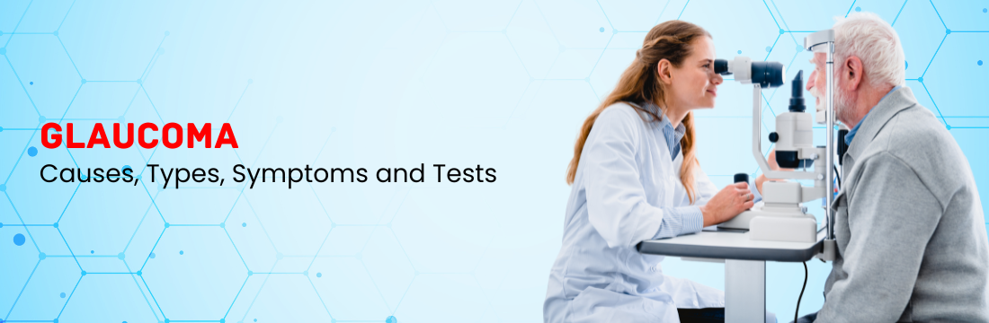 Glaucoma Explained: What are the Causes, Types, Symptoms, and Tests?